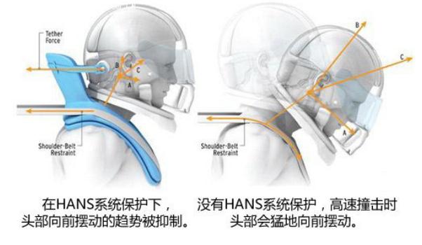 頭頸保護(hù)系統(tǒng)HANS，固定保護(hù)（更安全）